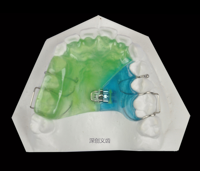 C-001 单面螺丝扩弓器